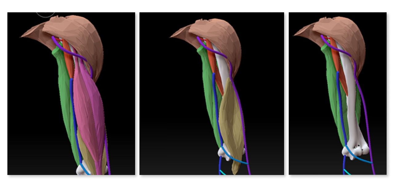 Three images of color-coded 3D model of upper arm